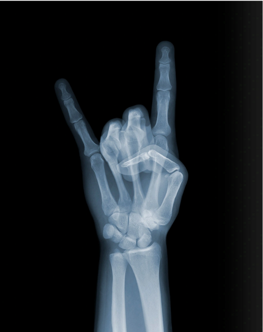Devil Horns-Photographic Print-Nick Veasey-Sorrel Sky Gallery