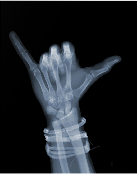 Hang Loose with Bands-Photographic Print-Nick Veasey-Sorrel Sky Gallery