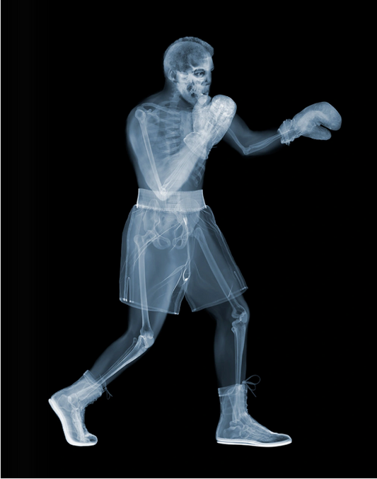Muhammad Ali-Photographic Print-Nick Veasey-Sorrel Sky Gallery