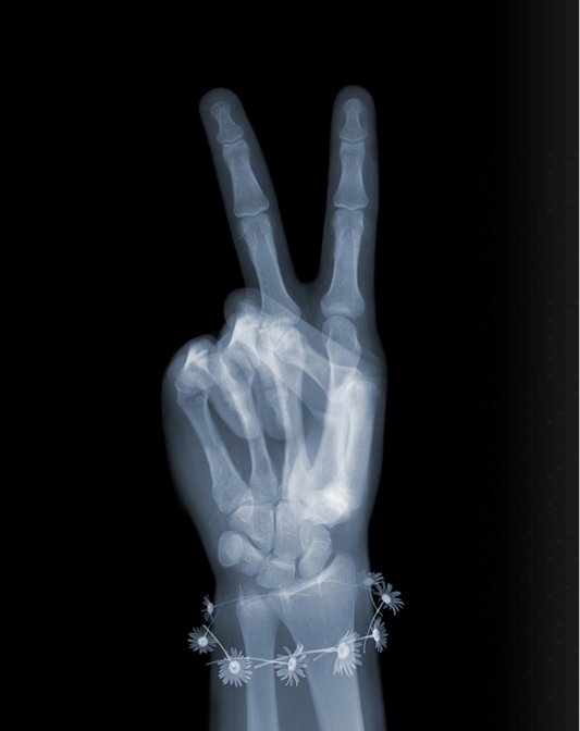 Peace with Daisies-Photographic Print-Nick Veasey-Sorrel Sky Gallery