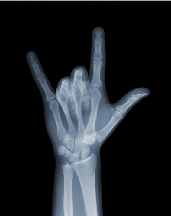 Rock On-Photographic Print-Nick Veasey-Sorrel Sky Gallery