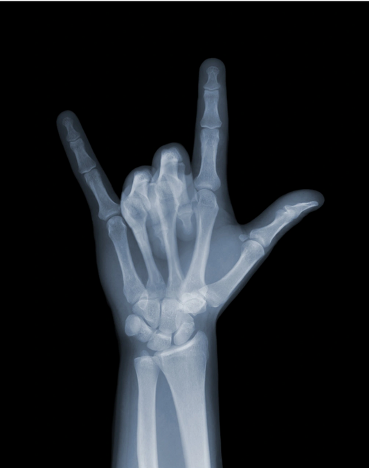 Rock On-Photographic Print-Nick Veasey-Sorrel Sky Gallery